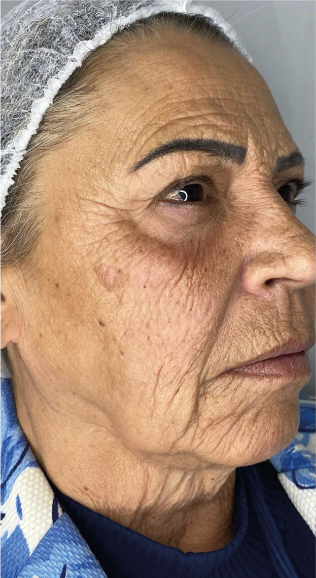 Ativo 2